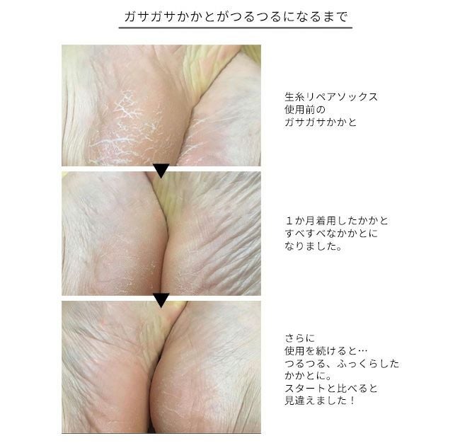 Hummingbird(ハミングバード)かかとつるつる生糸リペア五本指ソックス 620911 -4